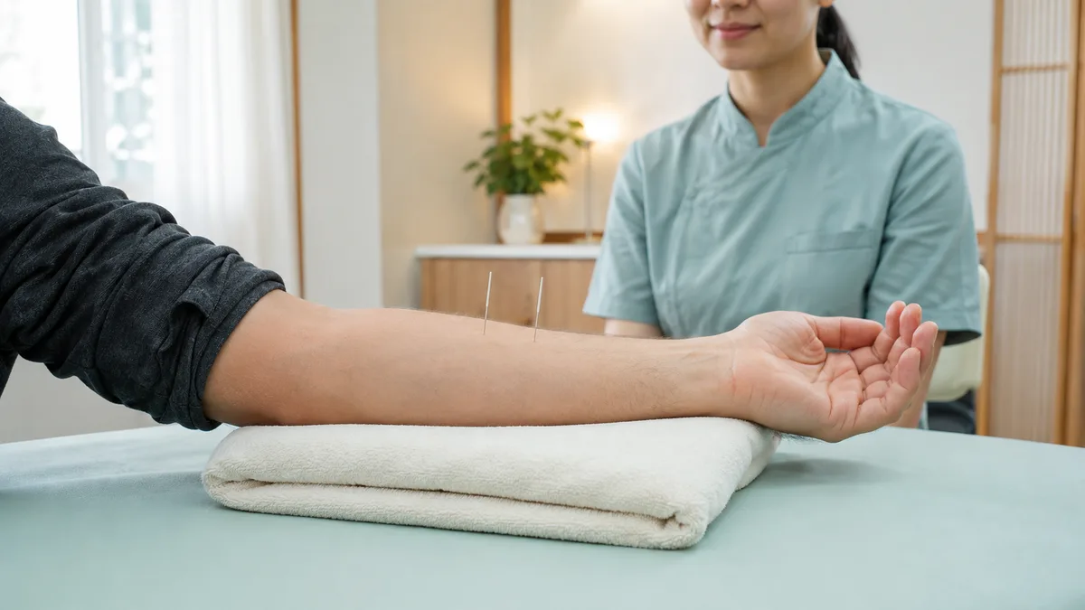 Acupuncture needles placed along a patient's forearm during treatment